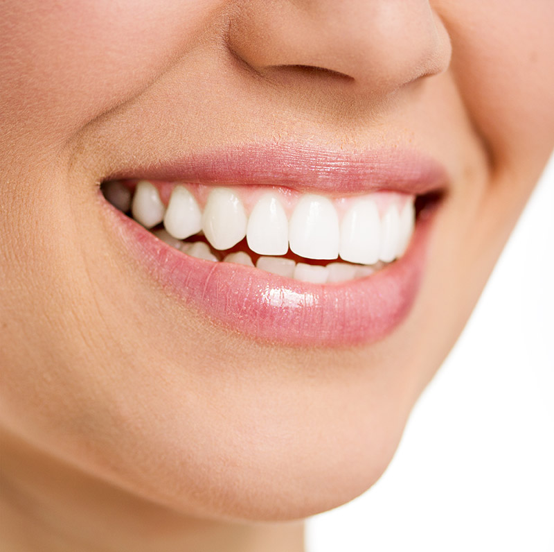Tanden bleken een stralende | Tandartspraktijk Kennemerland